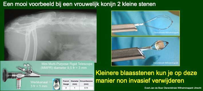 Cystoscopisch blaasstenen verwijderen.